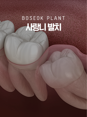 사랑니발치
