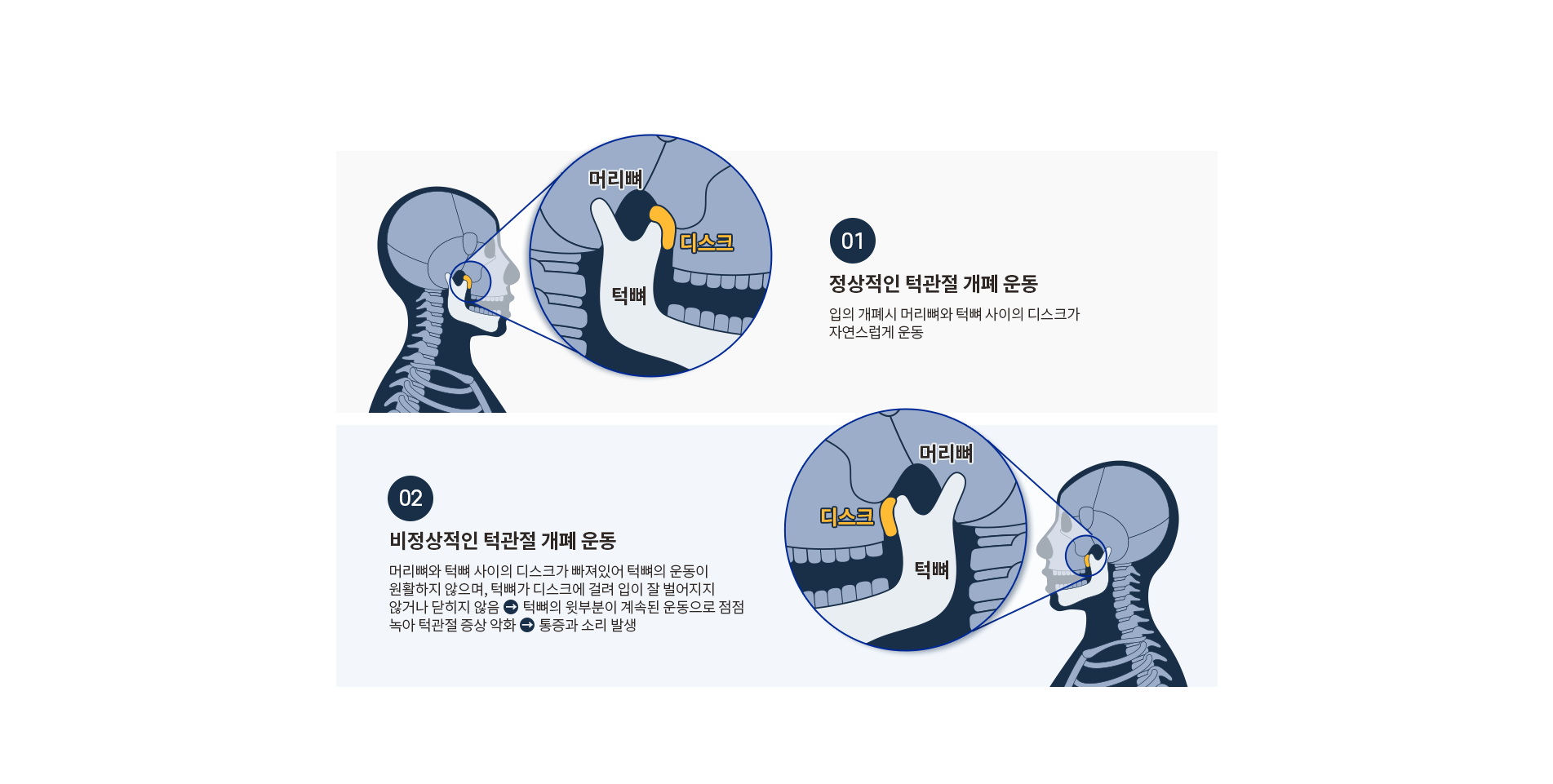 턱관절질환 비 정상적 개폐운동
