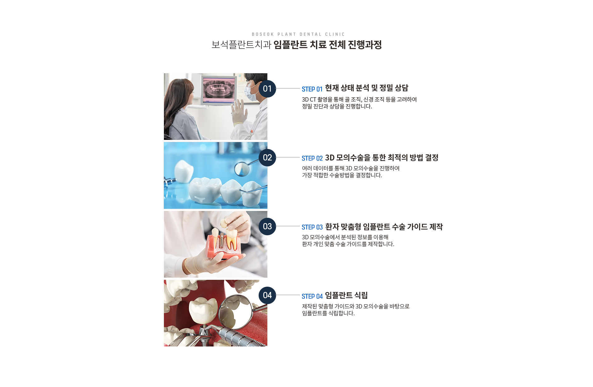 임플란트 치료 전체 진행과정