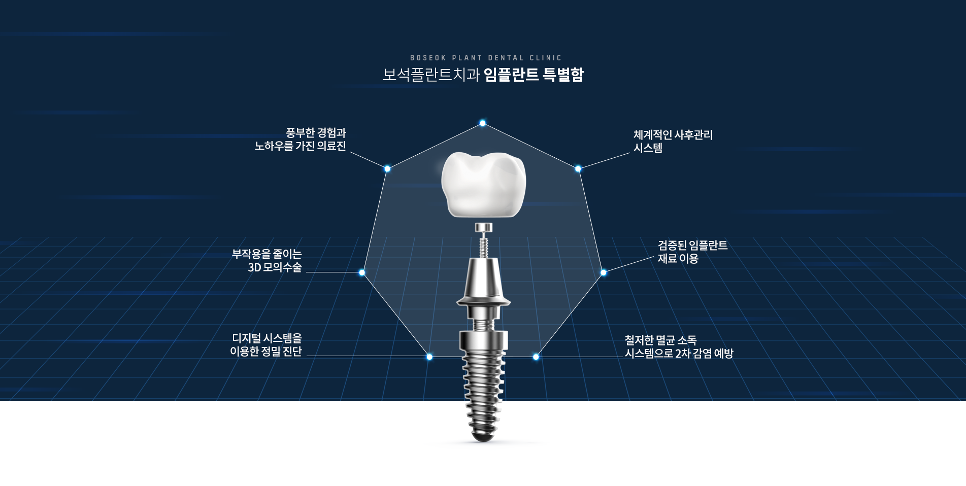 임플란트 특별함