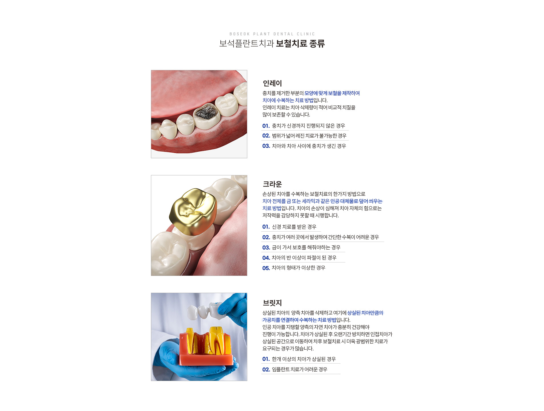 보철치료 종류
