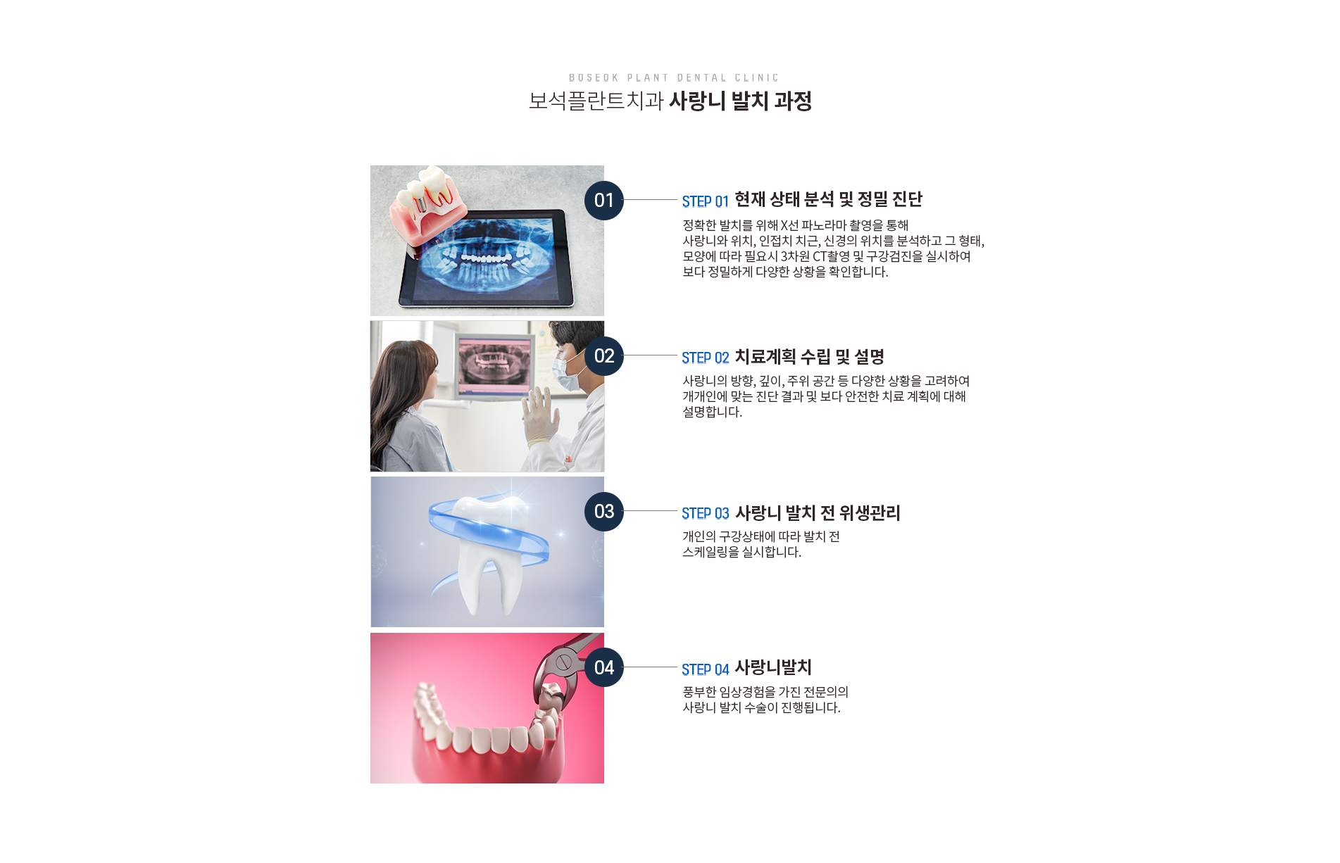 사랑니발치 과정